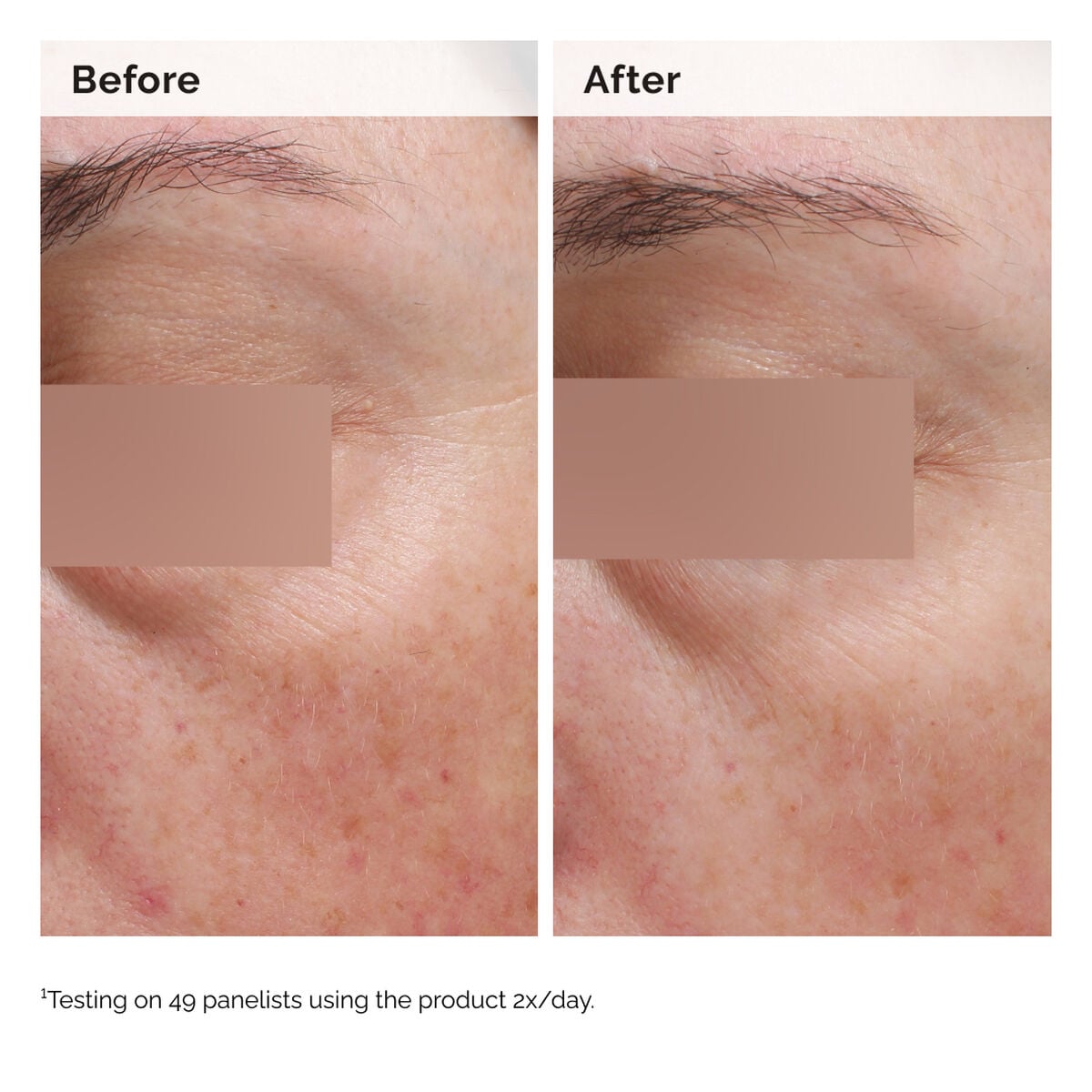niacinamide-5-face-and-body-emulsion-q2 2024-08-23-ORD-Nia-5pct-Face-Body-B-A-Elasticity-Global-02-1x1.jpg