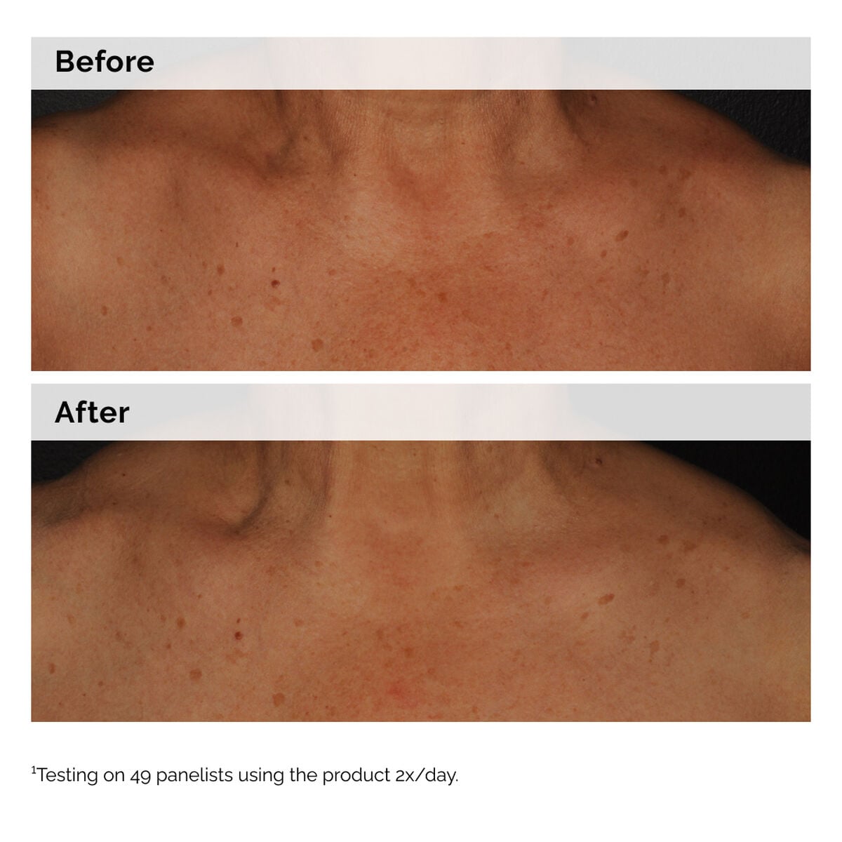 niacinamide-5-face-and-body-emulsion-q2 2024-08-23-ORD-Nia-5pct-Face-Body-B-A-Global-02-1x1.jpg