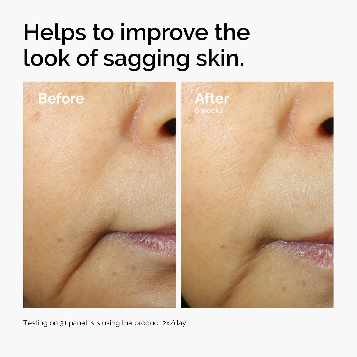 caffeine-3-escin-1-face-serum-l9 ord-caffeine-3pct-escin-1pct-face-serum-before-after-sagging.jpg