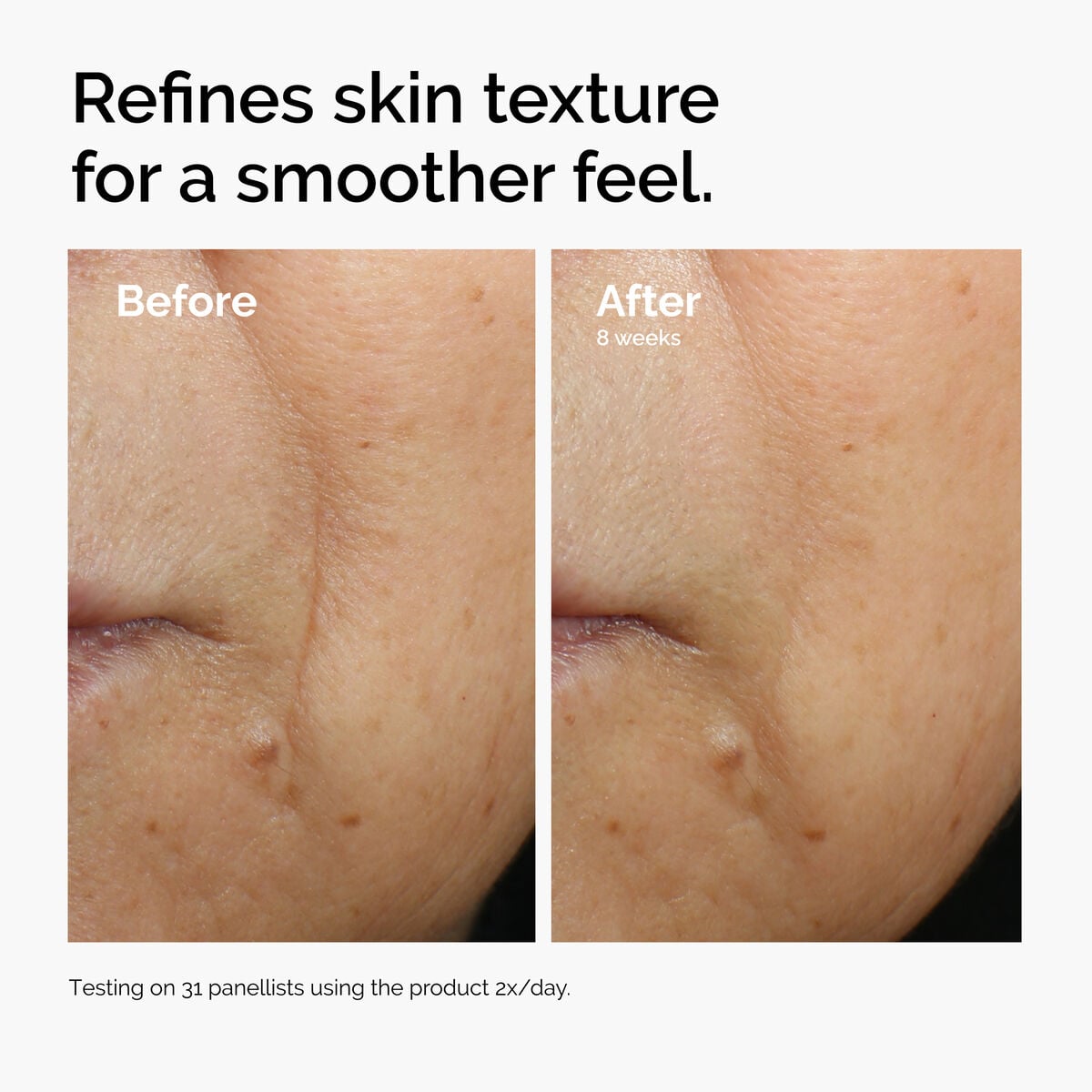 caffeine-3-escin-1-face-serum-l9 ord-caffeine-3pct-escin-1pct-face-serum-before-after-texture.jpg