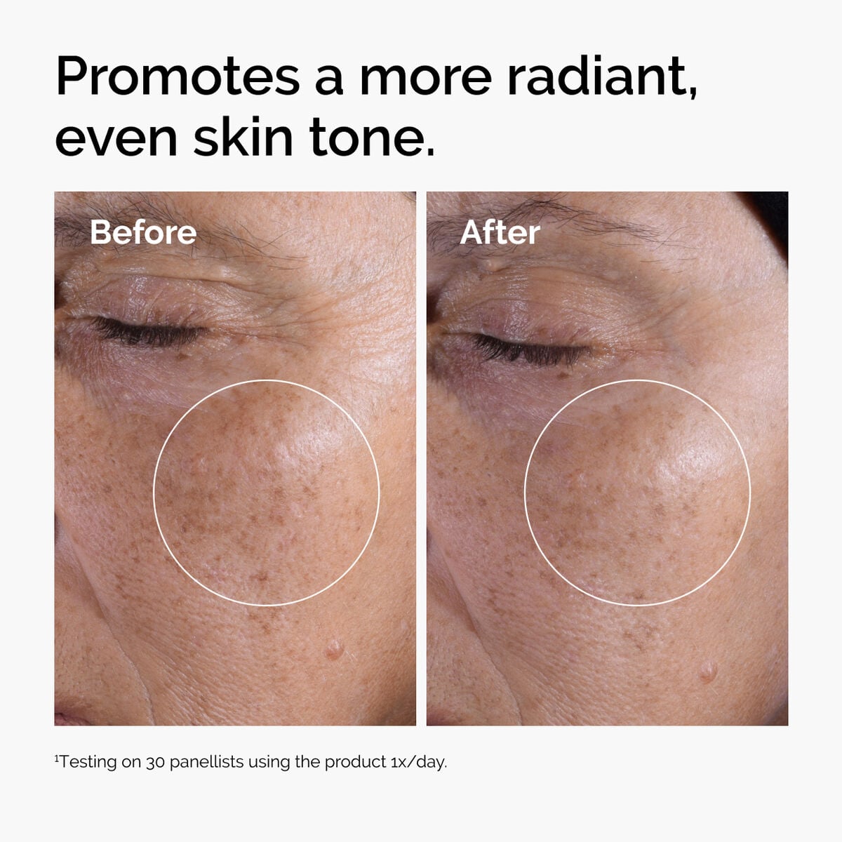 glycolic-acid-7-exfoliating-toner-d7 ord-glycolic-before-after-radiance.jpg