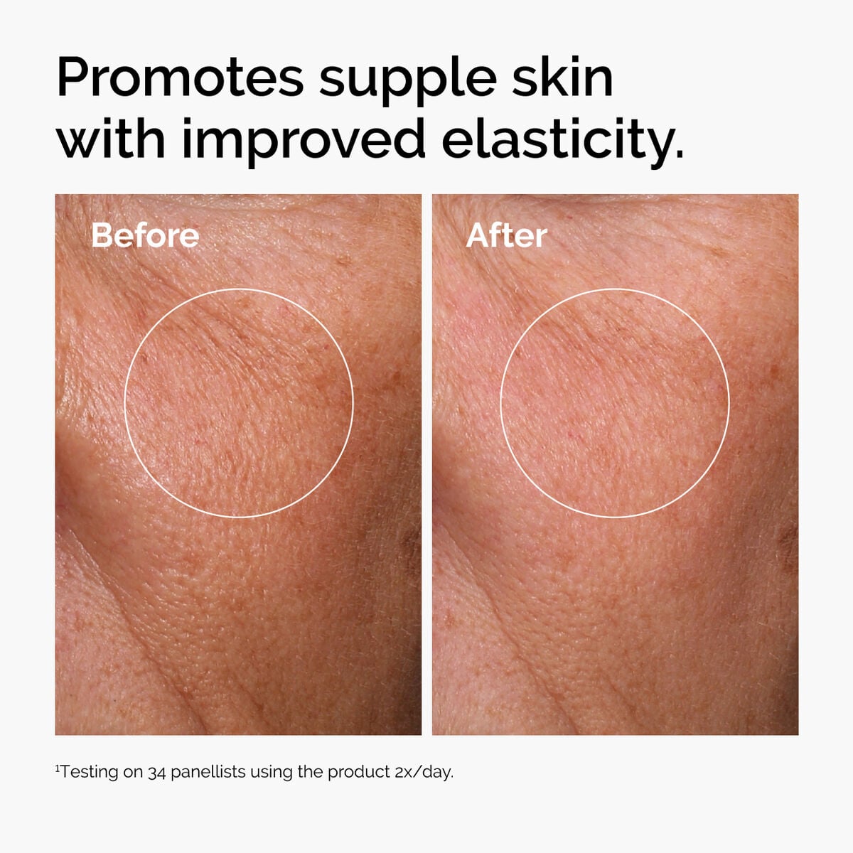 hyaluronic-acid-2-b5-with-ceramides-b6 ord-hyaluronic-acid-2pct-b5-hydrating-serum-before-after-elasticity.jpg