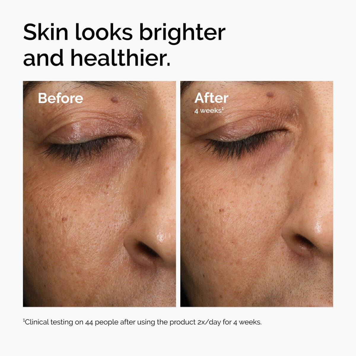 multi-antioxidant-radiance-serum-p2 ord-mars-before-after-healthy.jpg