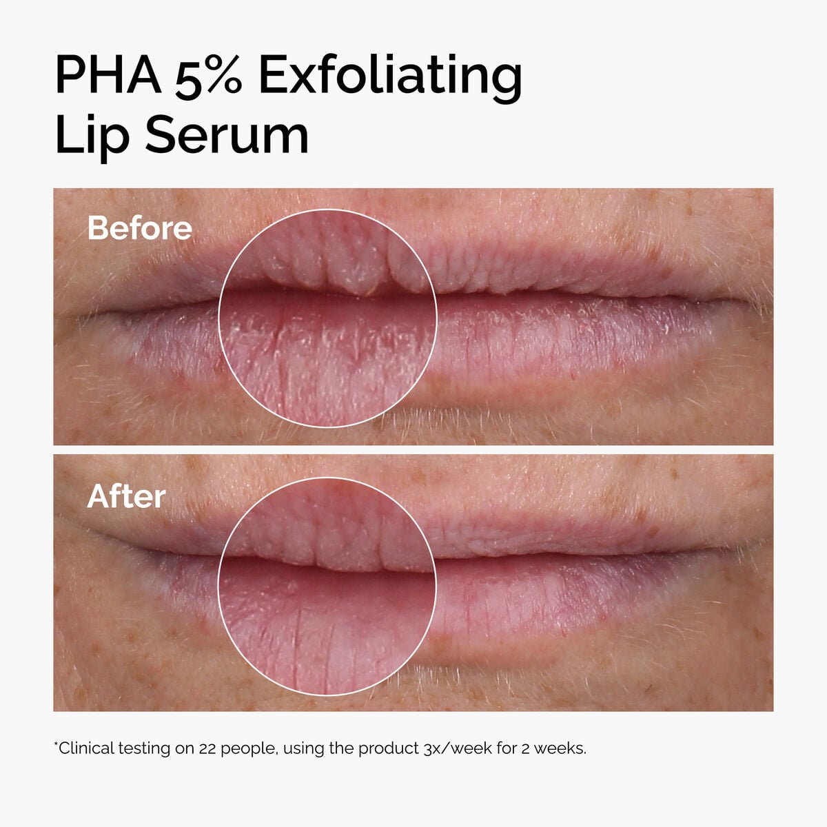 pha-5-exfoliating-lip-serum-e0 ord-pha-5pct-lip-exfoliating-serum-before-after.jpg